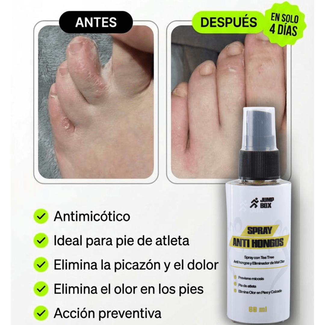 Spray Anti Hongos para Pies y Calzado 60ml - Nico de Jump Box