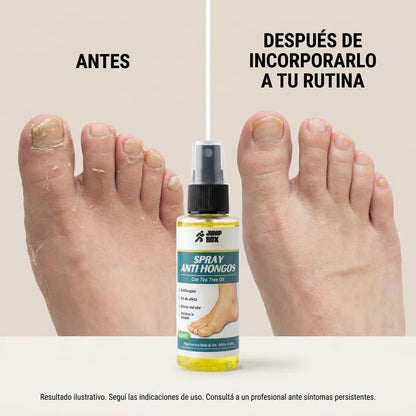 Spray Anti Hongos para Pies y Calzado 60ml - Nico de Jump Box