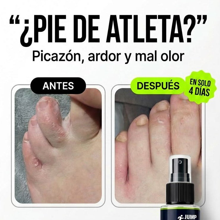 Spray K - O: Elimina Hongos en los Pies y Pie de Atleta | Natural 60ml - Nico de Jump Box