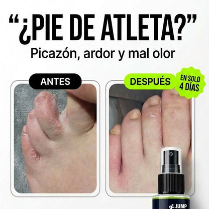 Spray K - O: Elimina Hongos en los Pies y Pie de Atleta | Natural 60ml - Nico de Jump Box